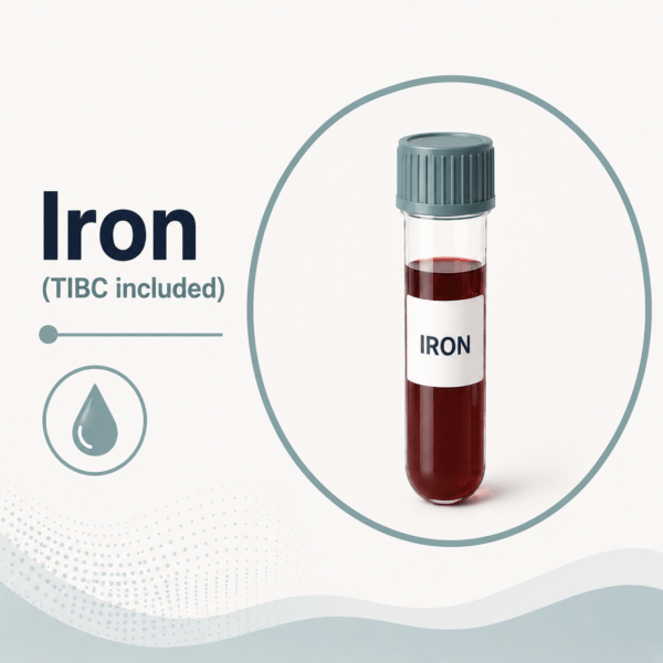 Serum Iron Test with TIBC (Total Iron-Binding Capacity)