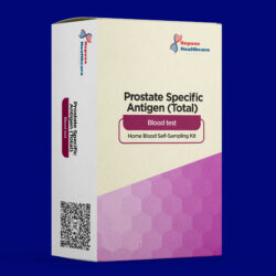 Prostate Specific Antigen (Total)