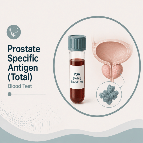 Prostate Specific Antigen (Total)