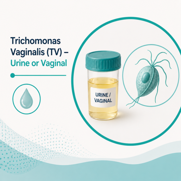 Trichomonas Vaginalis (TV) - Urine or Vaginal