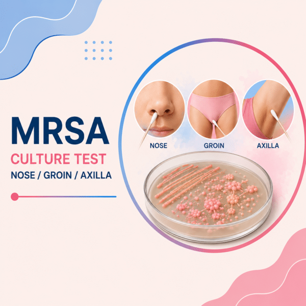 MRSA Culture - Nose/Groin/Axilla
