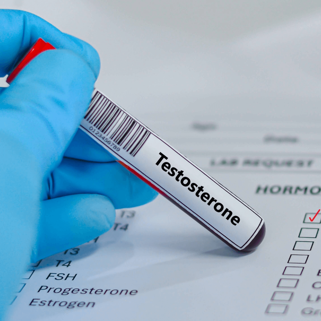 Male Hormone Blood Test Results Explained