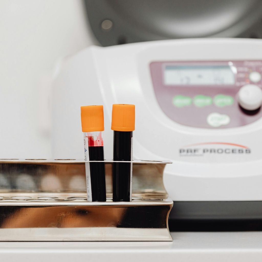 Must have blood tests if you're tired all the time