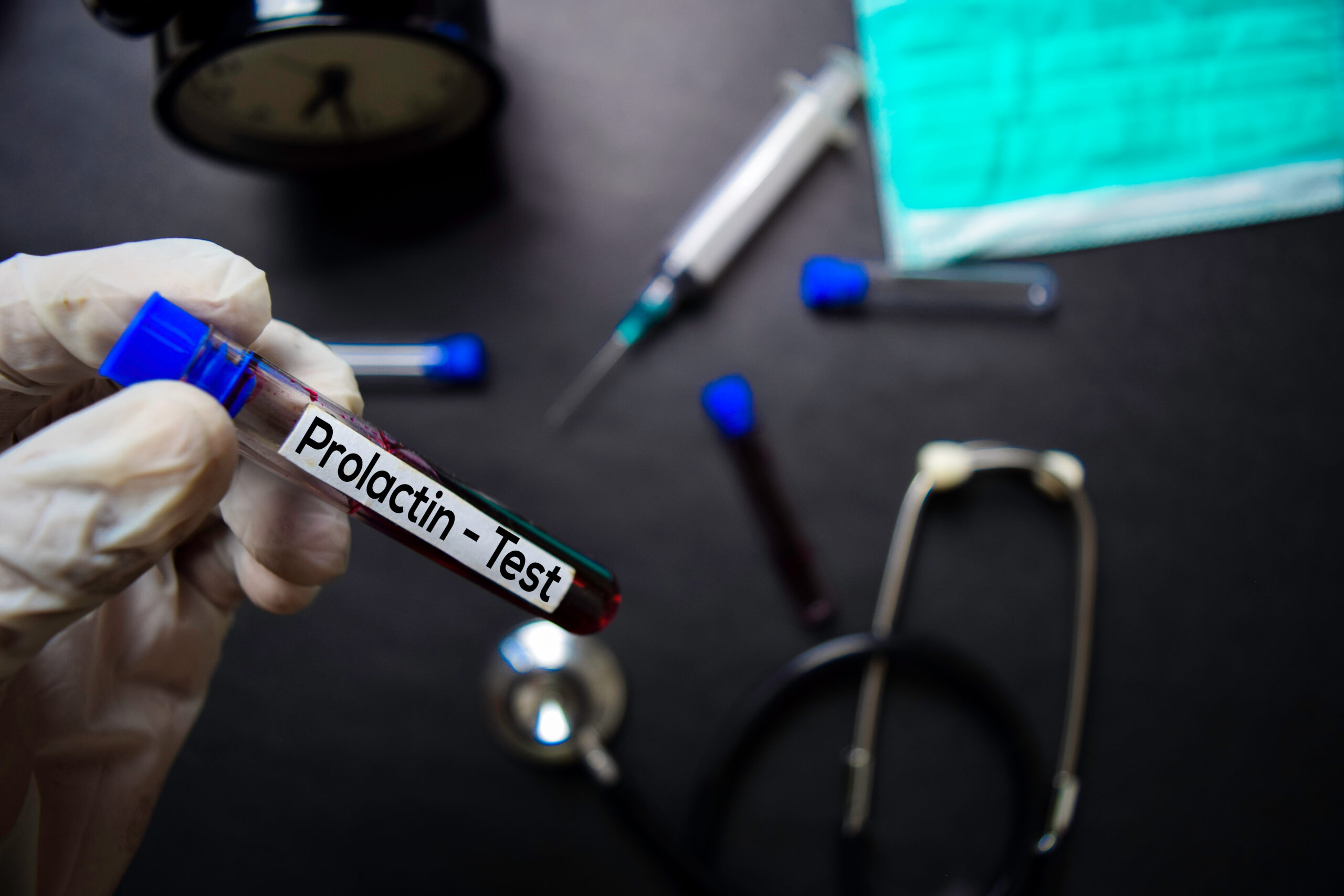prolactin test