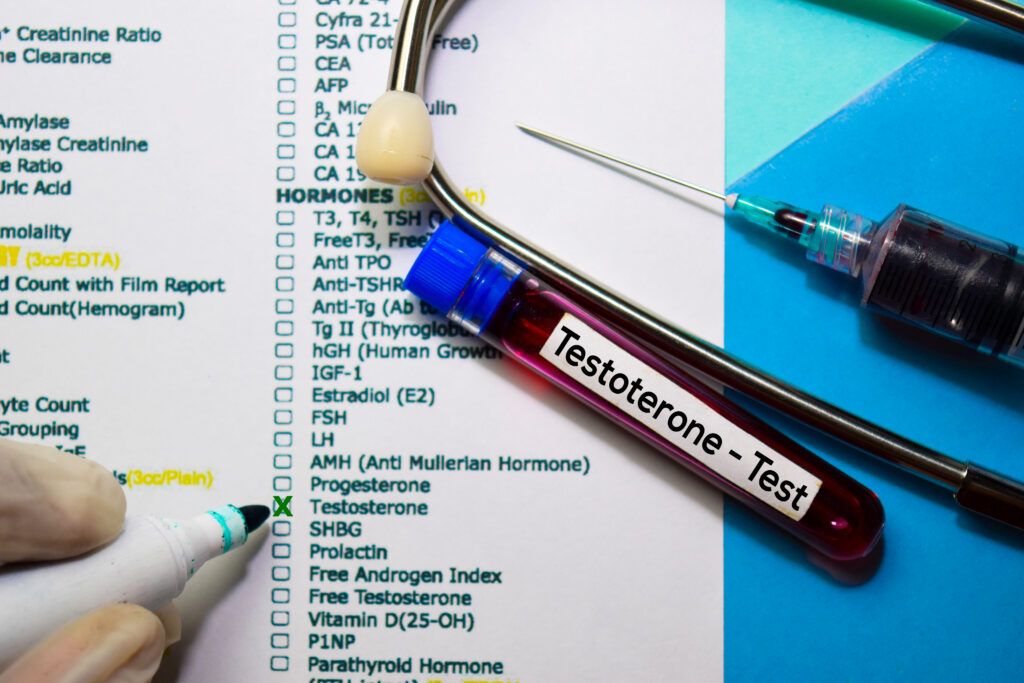testosterone test