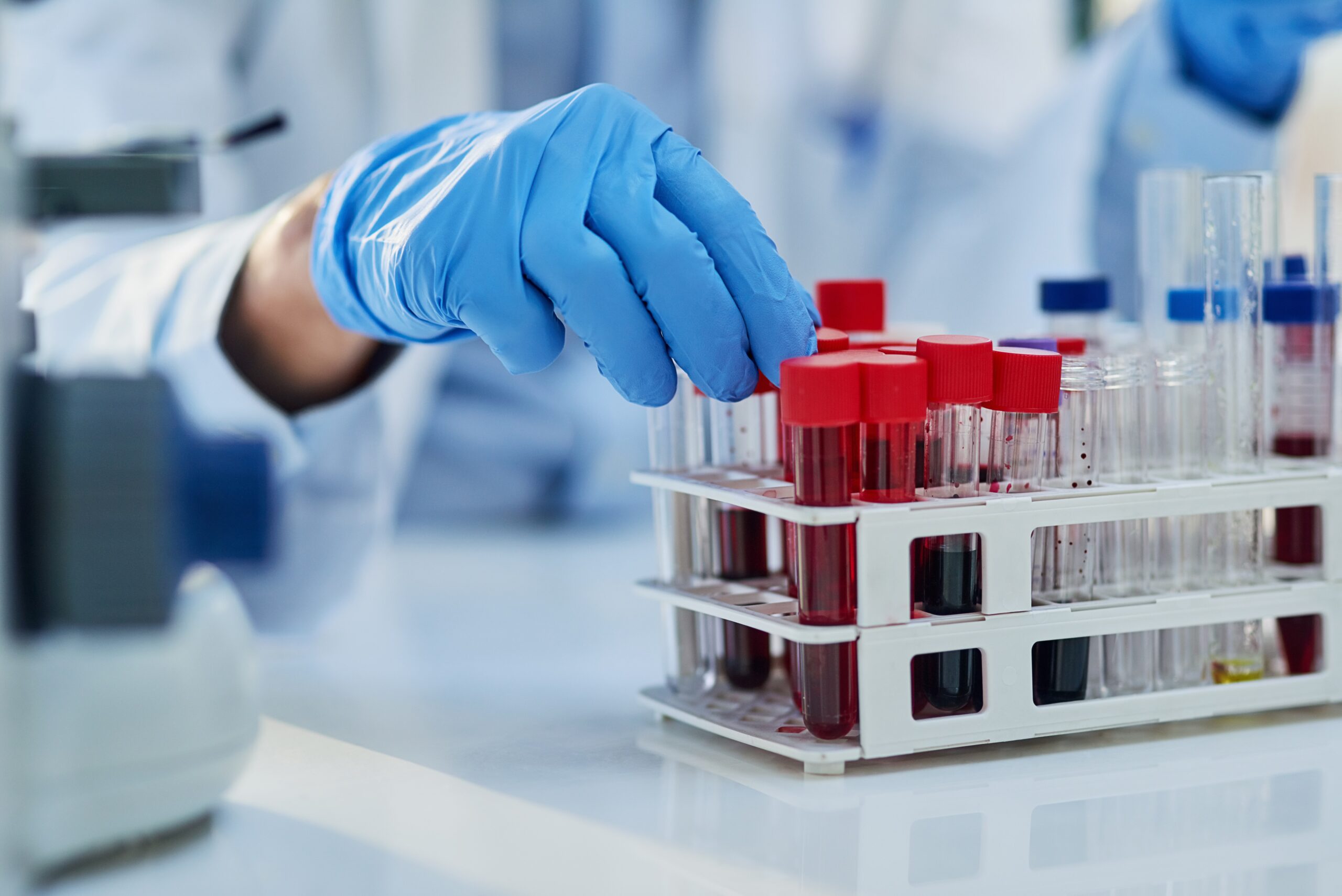 medical worker picking up blood test vials