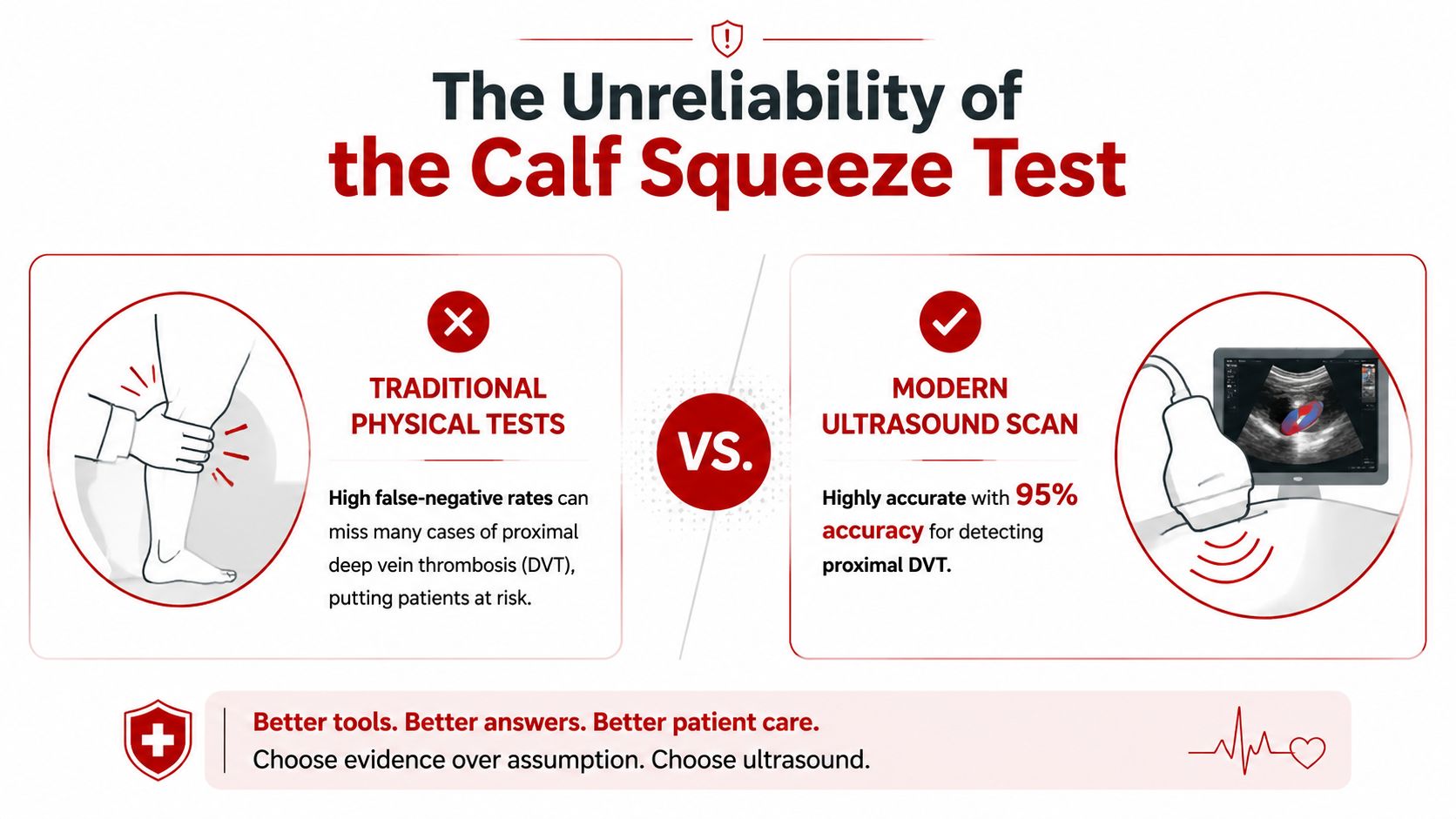 A comparison graphic showing the unreliability of manual calf squeeze tests versus accurate modern ultrasound scans for DVT.